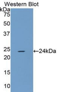 SMAD2 Antibody - Western blot of recombinant SMAD2.  This image was taken for the unconjugated form of this product. Other forms have not been tested.