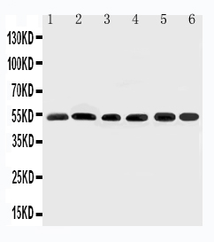SMAD2 Antibody - WB of SMAD2 antibody. Lane 1: Rat Brain Tissue Lysate. Lane 2: HELA Cell Lysate. Lane 3: SMMC Cell Lysate. Lane 4: JURKAT Cell Lysate. Lane 5: U87 Cell Lysate. Lane 6: MCF-7 Cell Lysate.
