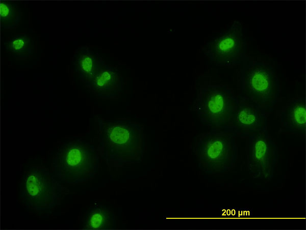 SMAD2 Antibody - Immunofluorescence of monoclonal antibody to SMAD2 on HeLa cell. [antibody concentration 10 ug/ml]