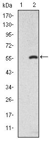 SMAD2 Antibody - SMAD2 Antibody in Western Blot (WB)