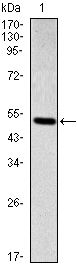 SMAD2 Antibody - SMAD2 Antibody in Western Blot (WB)