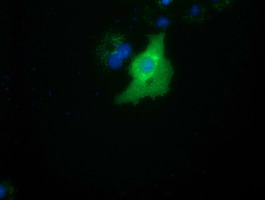 SMAD2 Antibody - Anti-SMAD2 mouse monoclonal antibody  immunofluorescent staining of COS7 cells transiently transfected by pCMV6-ENTRY SMAD2.