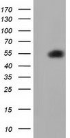 SMAD2 Antibody - HEK293T cells were transfected with the pCMV6-ENTRY control (Left lane) or pCMV6-ENTRY SMAD2 (Right lane) cDNA for 48 hrs and lysed. Equivalent amounts of cell lysates (5 ug per lane) were separated by SDS-PAGE and immunoblotted with anti-SMAD2.