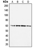 SMAD2 Antibody - Western blot analysis of SMAD2 expression in A431 (A); Jurkat (B); RAW264.7 (C); PC12 (D) whole cell lysates.