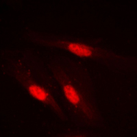 SMAD2 Antibody - Immunofluorescent analysis of SMAD2 staining in Jurkat cells. Formalin-fixed cells were permeabilized with 0.1% Triton X-100 in TBS for 5-10 minutes and blocked with 3% BSA-PBS for 30 minutes at room temperature. Cells were probed with the primary antibody in 3% BSA-PBS and incubated overnight at 4 C in a humidified chamber. Cells were washed with PBST and incubated with a DyLight 594-conjugated secondary antibody (red) in PBS at room temperature in the dark. DAPI was used to stain the cell nuclei (blue).