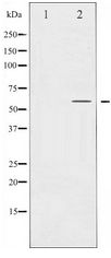 SMAD2 Antibody - Western blot of Smad2 expression in HepG2 whole cell lysates,The lane on the left is treated with the antigen-specific peptide.