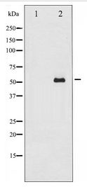SMAD2 Antibody - Western blot of Smad2 expression in 293 whole cell lysates,The lane on the left is treated with the antigen-specific peptide.