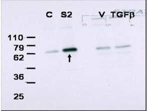 SMAD2 Antibody - Anti-Smad2 Antibody - Western Blot. Western blot of affinity purified anti-Smad2 to detect over-expressed Smad2 in COS cells (arrow). Lane C shows mock infection of COS cells with lentiviral vector alone. Lane S2 shows detection of Smad2 in lysates of COS transfected with Smad2. Lane V contains lysates of MDA-MB231 cells treated with vehicle; the next lane contains lysates of MDA-MB231 cells treated with TGF?. Low levels of staining in control lanes correspond to detection of endogenous Smad2. Preincubation of the antibody with immunizing peptide (data not shown) completely blocks specific band staining. The blot presented is askew relative to the molecular weight markers. The expected MW for Smad2 is 52 kD. The membrane was probed with the primary antibody at a 1:2500 dilution. Personal Communication Kathleen Flanders, CCR-NCI, Bethesda, MD.