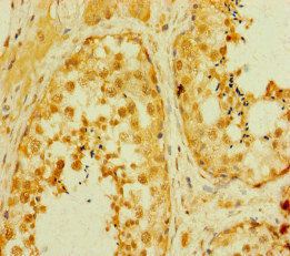 SMAD2 Antibody - Immunohistochemistry of paraffin-embedded human testis tissue at dilution of 1:100