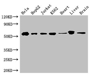 SMAD2 Antibody - Western Blot Positive WB detected in:Hela whole cell lysate,HepG2 whole cell lysate,Jurkat whole cell lysate,K562 whole cell lysate,Mouse heart tissue,Mouse liver tissue,Mouse brain tissue All Lanes: SMAD2 antibody at 3ug/ml Secondary Goat polyclonal to rabbit IgG at 1/50000 dilution Predicted band size: 53,49 kDa Observed band size: 52 kDa