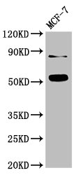 SMAD2 Antibody - Western Blot Positive WB detected in: MCF-7 whole cell lysate All lanes: SMAD2 antibody at 3µg/ml Secondary Goat polyclonal to rabbit IgG at 1/50000 dilution Predicted band size: 53, 49 kDa Observed band size: 53 kDa