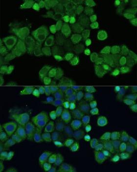 SMAD2 Antibody - Immunofluorescence analysis of HeLa cells using SMAD2 antibody at dilution of 1:100. Blue: DAPI for nuclear staining.
