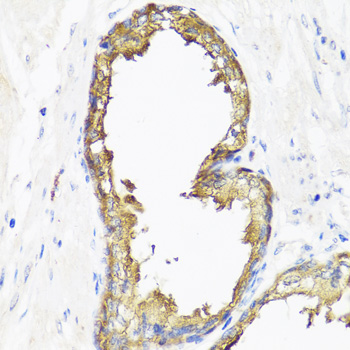 SMAD2 Antibody - Immunohistochemistry of paraffin-embedded human prostate using SMAD2 antibody at dilution of 1:100 (40x lens).