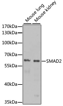 SMAD2 Antibody - Western blot analysis of extracts of various cell lines, using SMAD2 antibody at 1:1000 dilution. The secondary antibody used was an HRP Goat Anti-Rabbit IgG (H+L) at 1:10000 dilution. Lysates were loaded 25ug per lane and 3% nonfat dry milk in TBST was used for blocking. An ECL Kit was used for detection and the exposure time was 60s.