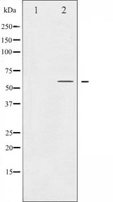 SMAD2 Antibody - Western blot analysis of Smad2 expression in HepG2 whole cells lysates. The lane on the left is treated with the antigen-specific peptide.