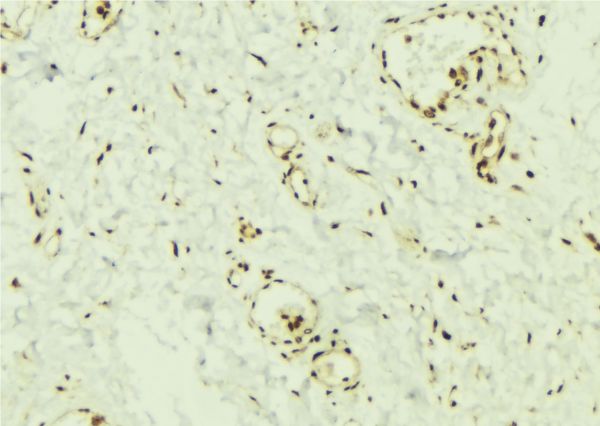 SMAD2 Antibody - 1:100 staining mouse muscle tissue by IHC-P. The sample was formaldehyde fixed and a heat mediated antigen retrieval step in citrate buffer was performed. The sample was then blocked and incubated with the antibody for 1.5 hours at 22°C. An HRP conjugated goat anti-rabbit antibody was used as the secondary.