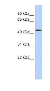 SMAD2 Antibody - SMAD2 antibody Western blot of Jurkat lysate. This image was taken for the unconjugated form of this product. Other forms have not been tested.