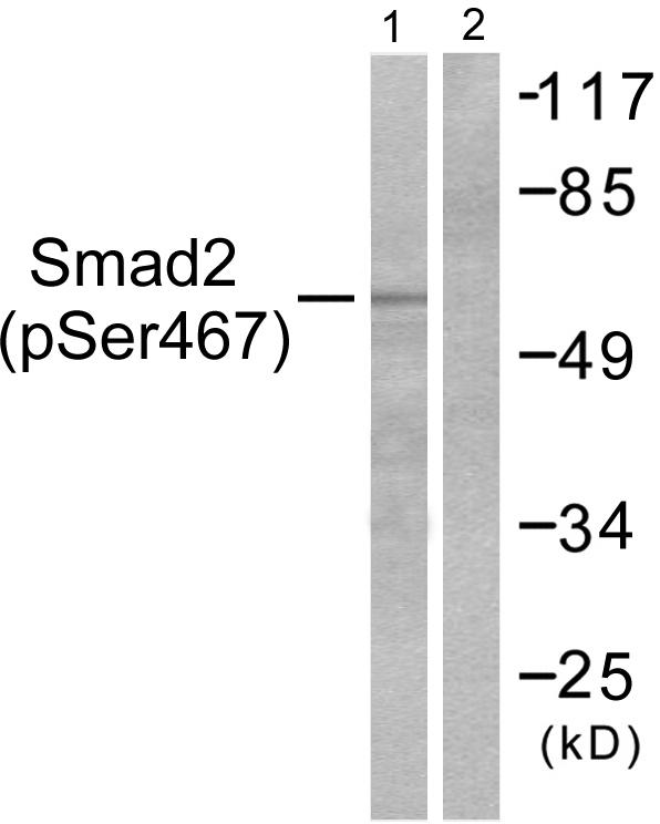 SMAD2 Antibody - Western blot analysis of extracts from HeLa cells treated with PMA (125ng/ml, 15mins), using Smad2 (Phospho-Ser467) antibody.