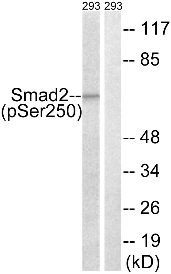 SMAD2 Antibody - Western blot analysis of lysates from 293 cells treated with PMA 125ng/ml 30', using Smad2 (Phospho-Ser250) Antibody. The lane on the right is blocked with the phospho peptide.