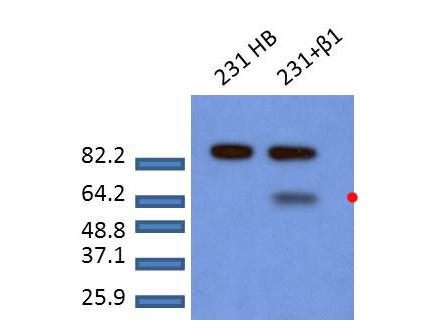 SMAD2 Antibody - Western Blot of Rabbit anti-Smad2 pS465pS467 antibody. Lane 1: MDA-MB-231 cells. Lane 2: MDA-MB-231 cells treated with TGF-ß1 for 1h. Load: 20 µg per lane. Primary antibody: Smad2pS465pS467 antibody at 1:1000 for overnight at 4°C. Secondary antibody: IRDye800™ rabbit secondary antibody at 1:10,000 for 45 min at RT.