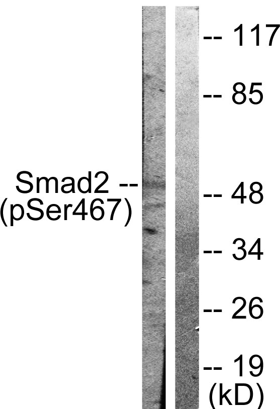 SMAD2 Antibody - Western blot analysis of lysates from HepG2 cells treated with PMA 125ng/ml 15', using Smad2 (Phospho-Ser467) Antibody. The lane on the right is blocked with the phospho peptide.