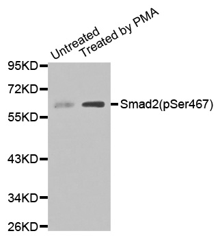 SMAD2 Antibody - Western blot analysis of extracts of Untreated and treated 293T cell lines.