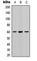 SMAD2 Antibody - Western blot analysis of SMAD2 (pS467) expression in human kidney (A); mouse brain (B); rat brain (C) whole cell lysates.