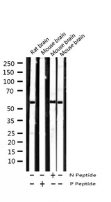 SMAD2 Antibody - Western blot analysis of Phospho-Smad2 (Ser467) expression in various lysates