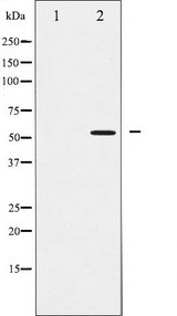 SMAD2 Antibody - Western blot analysis of Smad2 phosphorylation expression in PMA treated HepG2 whole cells lysates. The lane on the left is treated with the antigen-specific peptide.