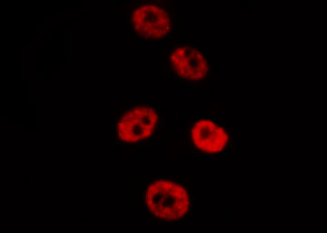 SMAD2 Antibody - Staining HepG2 cells by IF/ICC. The samples were fixed with PFA and permeabilized in 0.1% Triton X-100, then blocked in 10% serum for 45 min at 25°C. The primary antibody was diluted at 1:200 and incubated with the sample for 1 hour at 37°C. An Alexa Fluor 594 conjugated goat anti-rabbit IgG (H+L) Ab, diluted at 1/600, was used as the secondary antibody.