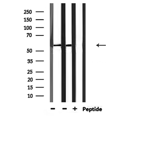 SMAD2 Antibody - Western blot analysis of extracts of rat brain, mouse muscle using Phospho-Smad2 (Ser467) antibody.
