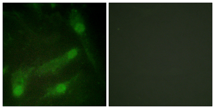 SMAD2 Antibody - Immunofluorescence analysis of HeLa cells, using Smad2 (Phospho-Thr220) Antibody. The picture on the right is blocked with the phospho peptide.