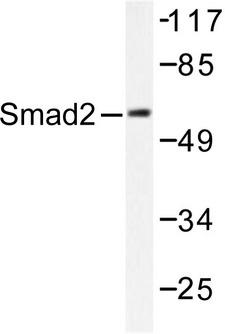 SMAD2 Antibody - Western blot of Smad2 (P459) pAb in extracts from HepG2 or K562 tested with UV 5'.