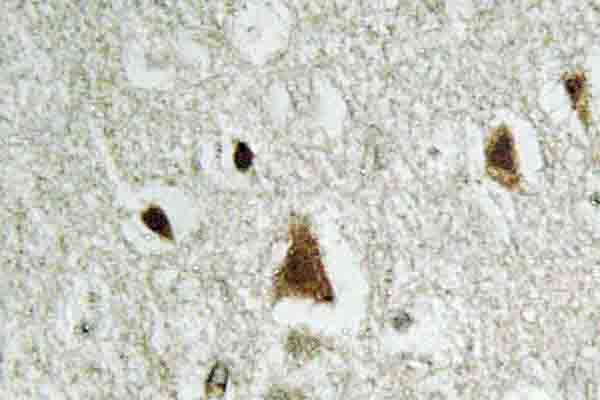 SMAD2 Antibody - IHC of Smad2 (Y216) pAb in paraffin-embedded human brain tissue.