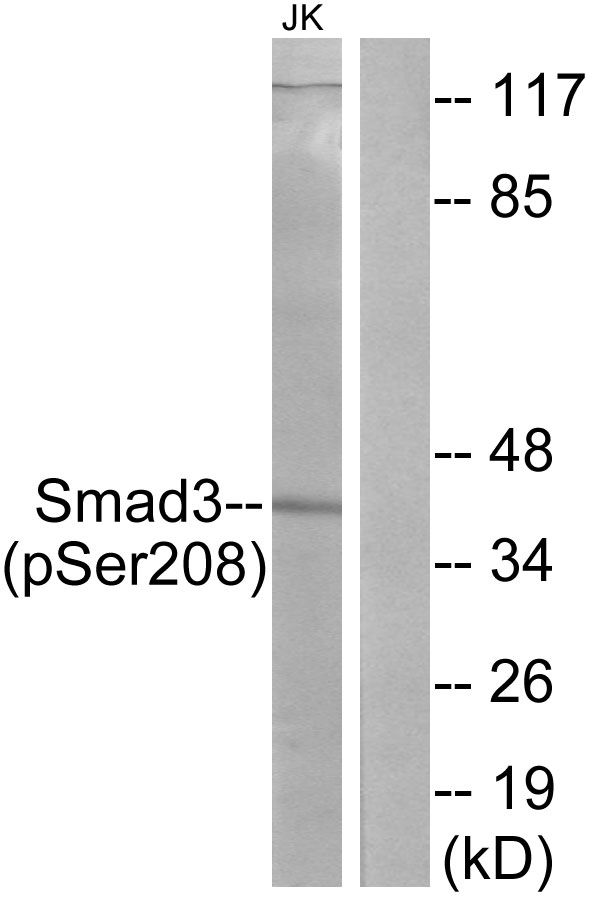 SMAD3 Antibody - Western blot analysis of lysates from Jurkat cells, using Smad3 (Phospho-Ser208) Antibody. The lane on the right is blocked with the phospho peptide.