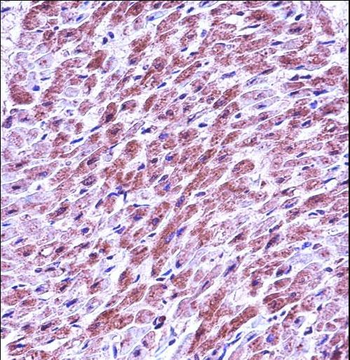 SMAD3 Antibody - SMAD3 Antibody immunohistochemistry of formalin-fixed and paraffin-embedded human heart tissue followed by peroxidase-conjugated secondary antibody and DAB staining.