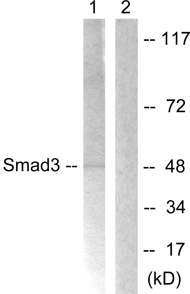 SMAD3 Antibody - Western blot analysis of lysates from HT-29 cells, using Smad3 Antibody. The lane on the right is blocked with the synthesized peptide.