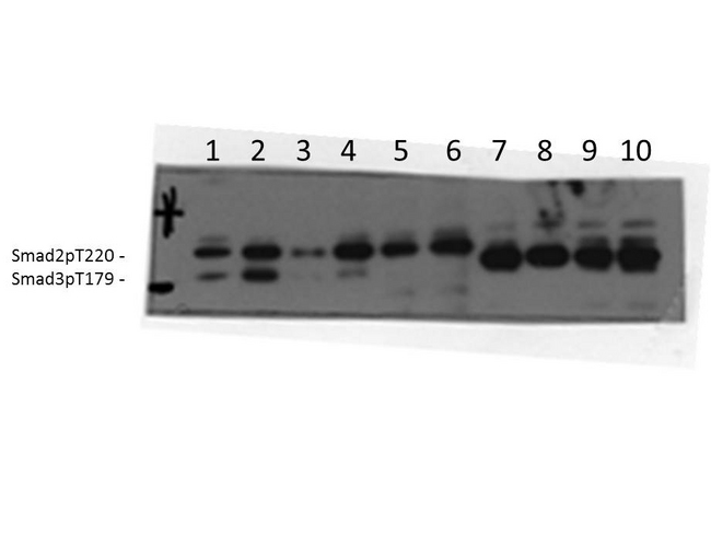 SMAD3 Antibody - Western blot of Rabbit Anti-SMAD3 antibody. Lane 1: AML12 unstimulated. Lane 2: AML12 stimulated with TGFB. Lane 3: MEFwt unstimulated. Lane 4: MEFwt stimulated with TGFB. Lane 5: MEF Smad3 KO unstimulated. Lane 6: MEF Smad3 KO stimulated with TGFB. Lane 7: HEK293 Smad3T179A mutant unstimulated. Lane 8: HEK293 Smad3T179A mutant stimulated with TGFB. Lane 9: HEK293 Smad3T179V mutant unstimulated. Lane 10: HEK293 Smad3T179V mutant stimulated with TGFB. Load: 35 ug per lane. Primary antibody: SMAD 3 antibody at 1:1000 for overnight at 4C. Secondary antibody: IRDye800 rabbit secondary antibody at 1:10000 for 45 min at RT. Block: 5% BLOTTO overnight at 4C. Predicted/Observed size: 48.1kDa. Other band(s): Smad2pT220.