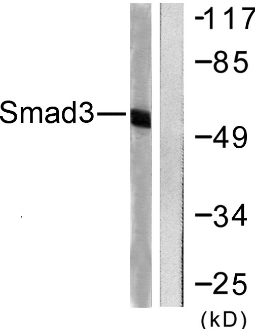 SMAD3 Antibody - Western blot analysis of lysates from 293 cells, treated with UV 5', using Smad3 Antibody. The lane on the right is blocked with the synthesized peptide.