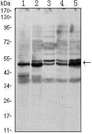 SMAD3 Antibody - Western blot using SMAD3 mouse monoclonal antibody against A549 (1), HeLa (2), Jurkat (3), PC-2 (4) and NIH/3T3 (5) cell lysate.