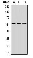 SMAD3 Antibody - Western blot analysis of SMAD3 expression in SKOV3 (A); HeLa (B); MCF7 (C) whole cell lysates.