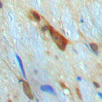 SMAD3 Antibody - Immunohistochemical analysis of SMAD3 staining in human brain formalin fixed paraffin embedded tissue section. The section was pre-treated using heat mediated antigen retrieval with sodium citrate buffer (pH 6.0). The section was then incubated with the antibody at room temperature and detected using an HRP-conjugated compact polymer system. DAB was used as the chromogen. The section was then counterstained with hematoxylin and mounted with DPX.