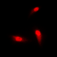 SMAD3 Antibody - Immunofluorescent analysis of SMAD3 staining in HeLa cells. Formalin-fixed cells were permeabilized with 0.1% Triton X-100 in TBS for 5-10 minutes and blocked with 3% BSA-PBS for 30 minutes at room temperature. Cells were probed with the primary antibody in 3% BSA-PBS and incubated overnight at 4 deg C in a humidified chamber. Cells were washed with PBST and incubated with a DyLight 594-conjugated secondary antibody (red) in PBS at room temperature in the dark. DAPI was used to stain the cell nuclei (blue).