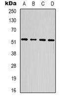 SMAD3 Antibody - Western blot analysis of SMAD3 expression in 293T (A); Jurkat (B); mouse heart (C); rat heart (D) whole cell lysates.