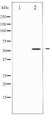 SMAD3 Antibody - Western blot of Smad3 expression in 293 whole cell lysates,The lane on the left is treated with the antigen-specific peptide.