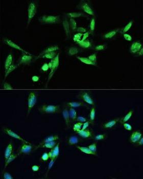 SMAD3 Antibody - Immunofluorescence analysis of U2OS cells using SMAD3 antibody at dilution of 1:100. Blue: DAPI for nuclear staining.