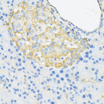 SMAD3 Antibody - Immunohistochemistry of paraffin-embedded rat islets of langerhans using SMAD3 antibody at dilution of 1:100 (40x lens).