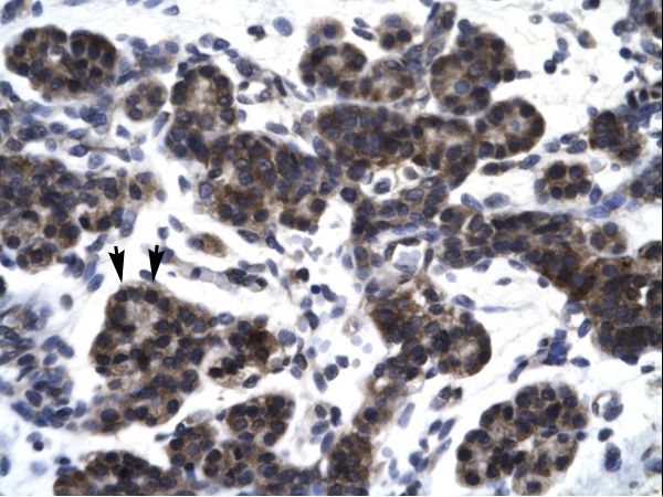 SMAD3 Antibody - SMAD3 antibody P100621_T100-NP_005893-SMAD3 (SMAD family member 3) Antibody was used in IHC to stain formalin-fixed, paraffin-embedded human pancreas.  This image was taken for the unconjugated form of this product. Other forms have not been tested.
