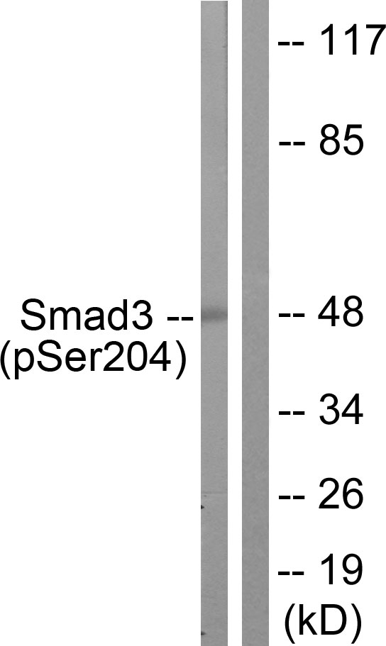 SMAD3 Antibody - Western blot analysis of lysates from NIH/3T3 cells treated with Serum 20% 15', using Smad3 (Phospho-Ser204) Antibody. The lane on the right is blocked with the phospho peptide.