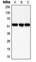 SMAD3 Antibody - Western blot analysis of SMAD3 (pS204) expression in HeLa UV-treated (A); SP2/0 UV-treated (B); H9C2 UV-treated (C) whole cell lysates.